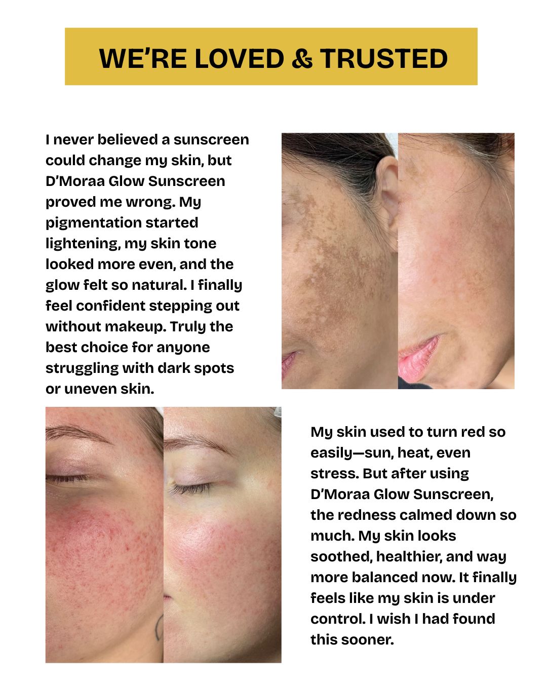 Glow ++ Hydrating Ozonated Water Sunscreen with SPF 50+ PA+++ | All Skin Type - 50GM