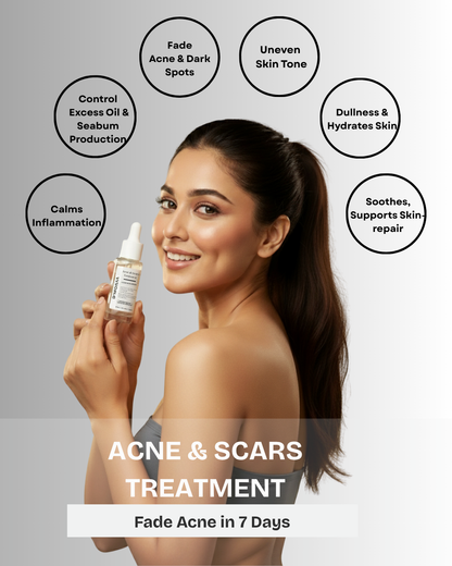 Acne & Scar Treatment Serum | All Skin Type - 30ml